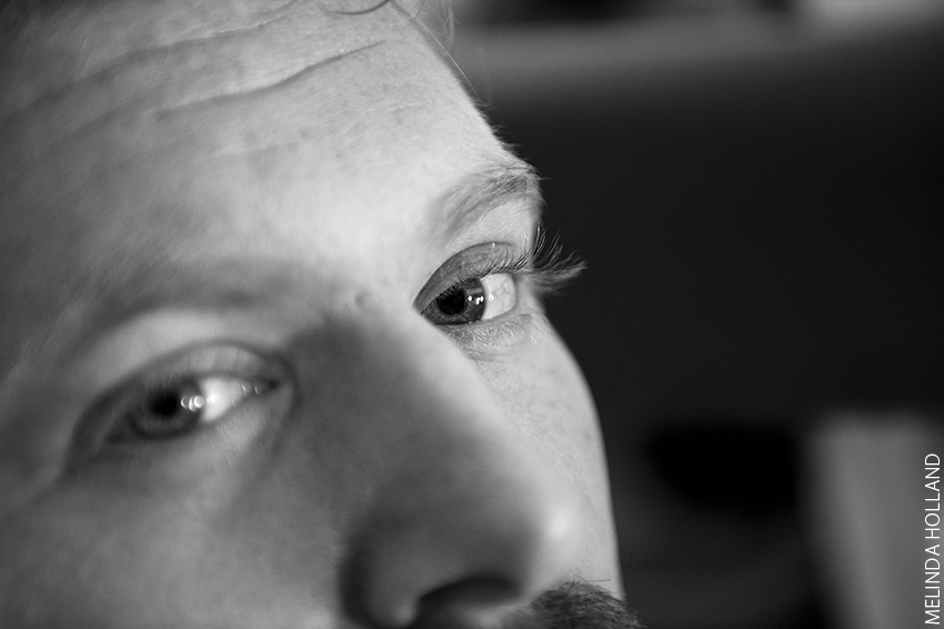 Todd, both eyes, b/w Todd, both eyes, b/w